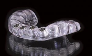 راهنمای جراحی ایمپلنت دندان