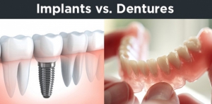 فرق بین ایمپلنت های دندانی و دندان های مصنوعی
