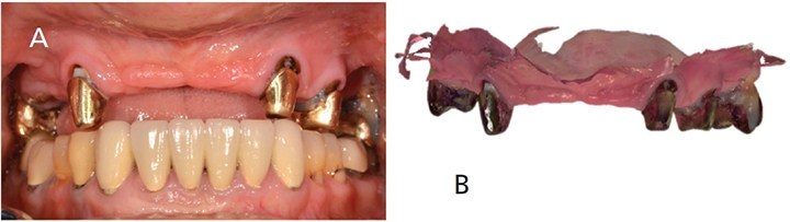  استراتژی دیجیتال در ایمپلنت دندان مدرن