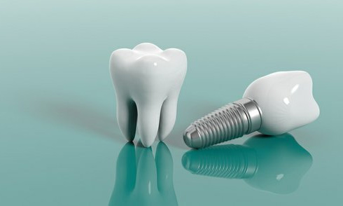 ایمپلنت یک روزه دندانپزشکی نارمک