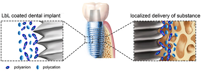 ایمپلنت دندان و انتی بیوتیک
