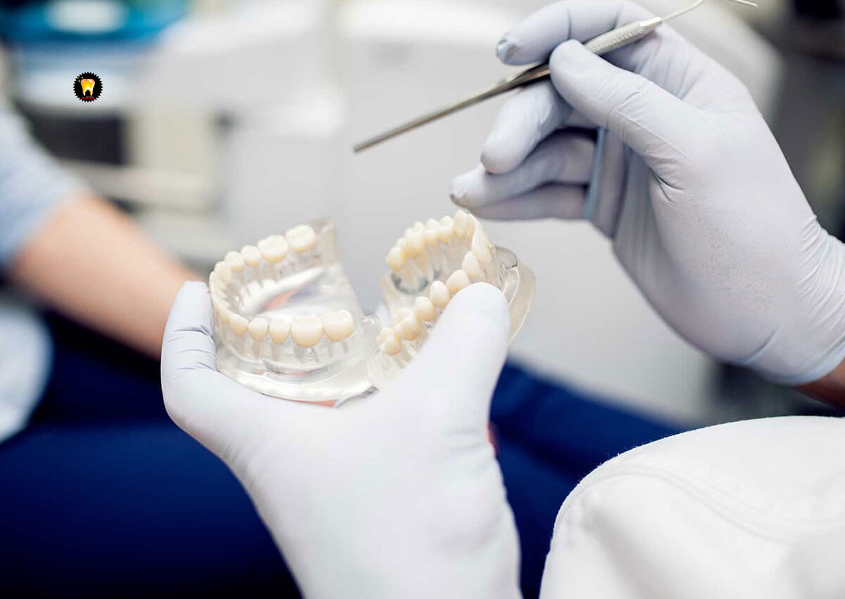 ایمپلنت دندان و عوامل عدم موفقیت آن