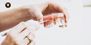 ایمپلنت دندان و درمان ارتودنسی