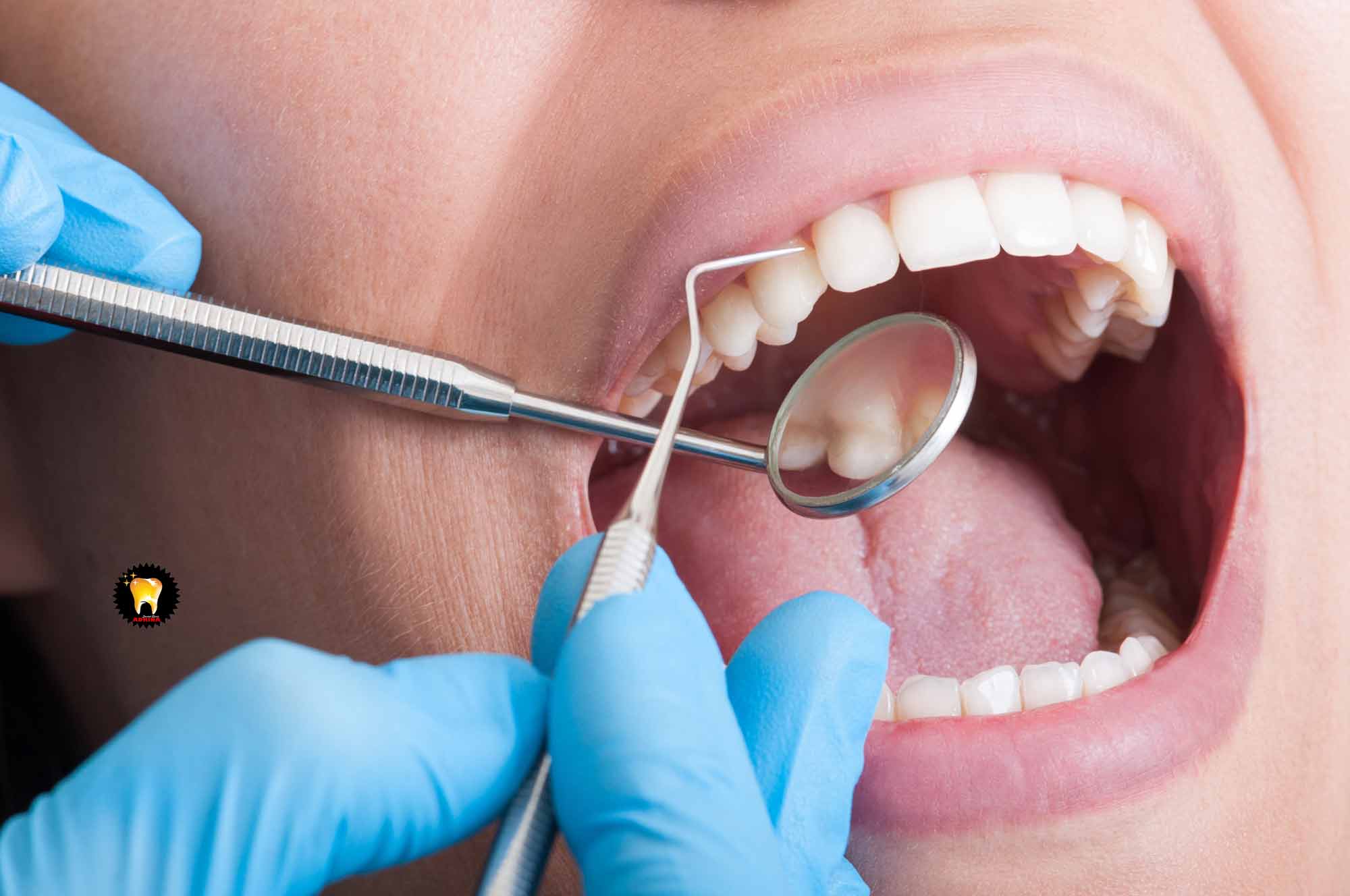 ایمپلنت دندان و شرایط مناسب کاشت
