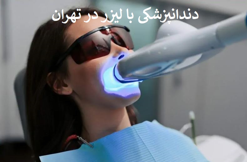 دندانپزشکی با لیزر در تهران