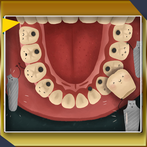 مراقبت ایمپلنت دندان و مراحل آن